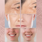 BrisoCollagen™ - Máscara Facial Pro LED