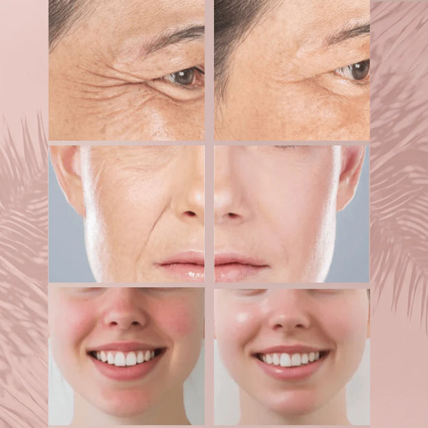 BrisoCollagen™ - Máscara Facial Pro LED