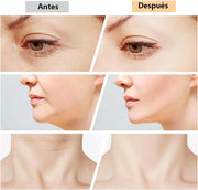 Masajeador Facial y Papada Brisoo™