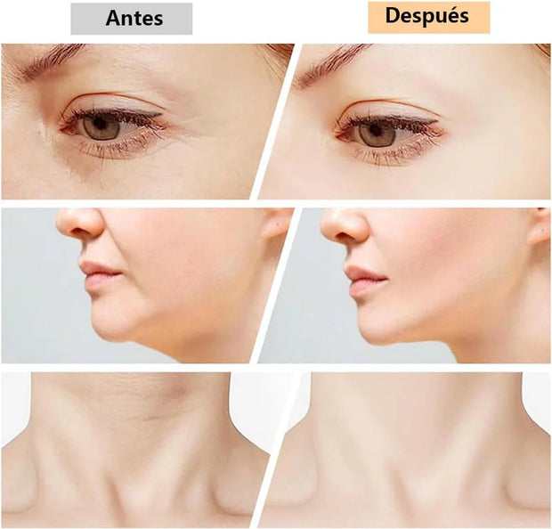 Masajeador Facial y Papada Brisoo™